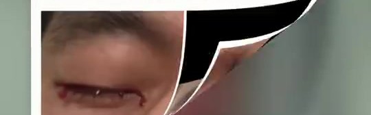 眼科专家谈郭艾伦：结膜受伤经处理大概率恢复得不错 不要太忧心